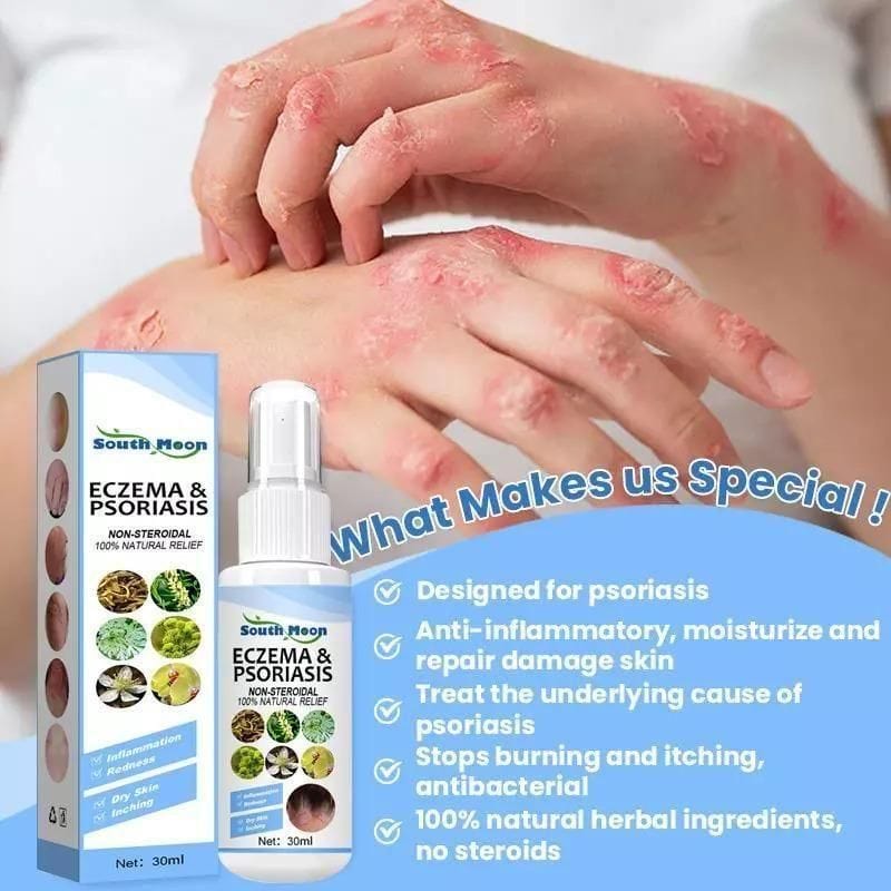 Herbal Psoriasis Relief Spray