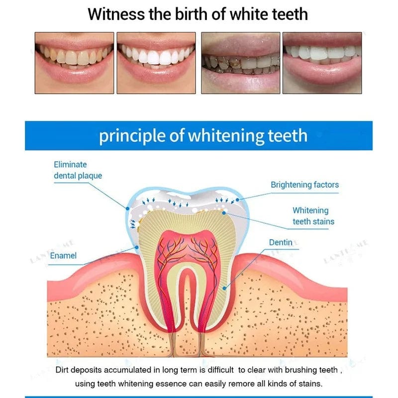 Dentipen™️