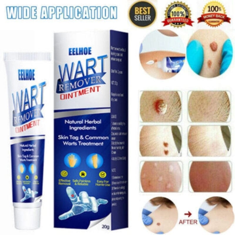 Wart Remover Ice Cream Mask